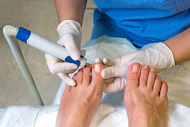 Nail Surgery